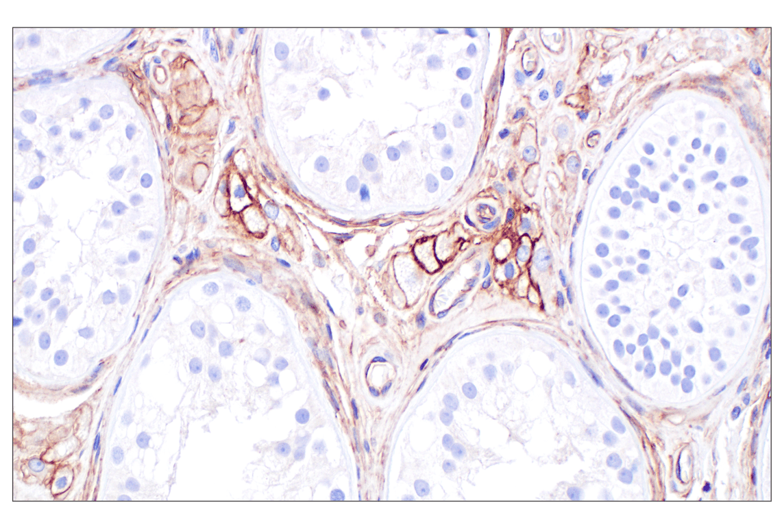 Immunohistochemistry Image 5: CD105/Endoglin (F9C5Q) Rabbit mAb