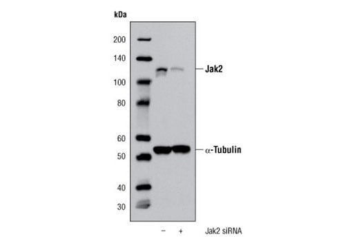 undefined Image 1: SignalSilence<sup>®</sup> Jak2 siRNA I