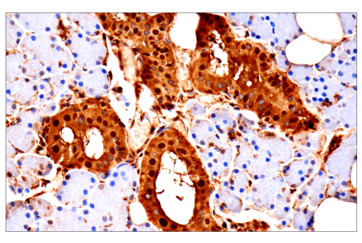 Immunohistochemistry Image 7: Ubiquitin (E6K4Y) XP<sup>®</sup> Rabbit mAb (BSA and Azide Free)