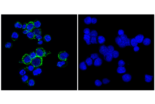 Immunofluorescence Image 1: CD20 (E7B7T) XP<sup>®</sup> Rabbit mAb