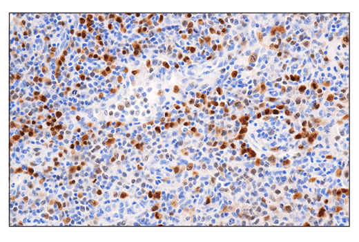 Immunohistochemistry Image 2: IRF-4 (E8H3S) XP<sup>®</sup> Rabbit mAb (BSA and Azide Free)