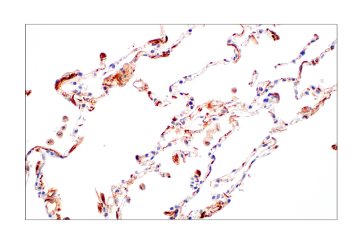 undefined Image 33: Late-Onset Alzheimer's Disease Risk Gene Antibody Sampler Kit