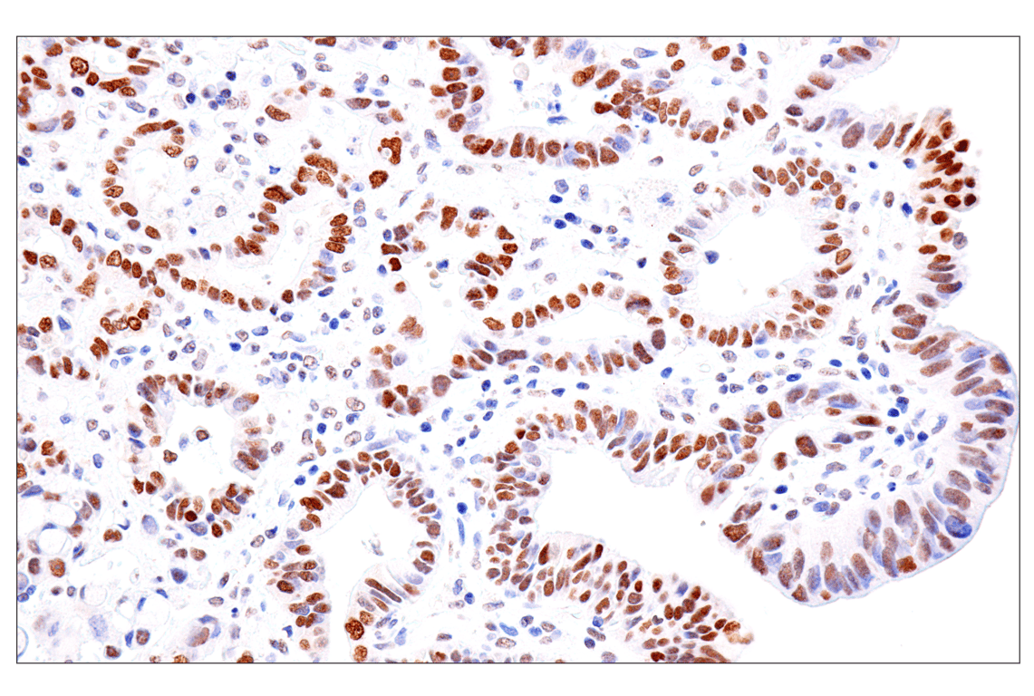 Immunohistochemistry Image 8: FoxA1/HNF3α (IHC578) Mouse mAb
