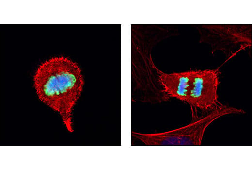 Immunofluorescence Image 1: Phospho-Histone H3 (Ser10) (D2C8) XP<sup>®</sup> Rabbit mAb