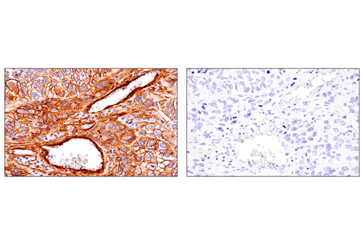 Immunohistochemistry Image 2: CD248 (E9Z7O) XP<sup>®</sup> Rabbit mAb