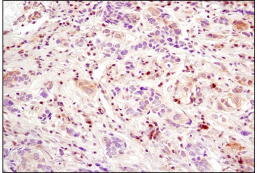 undefined Image 33: Angiogenesis Antibody Sampler Kit