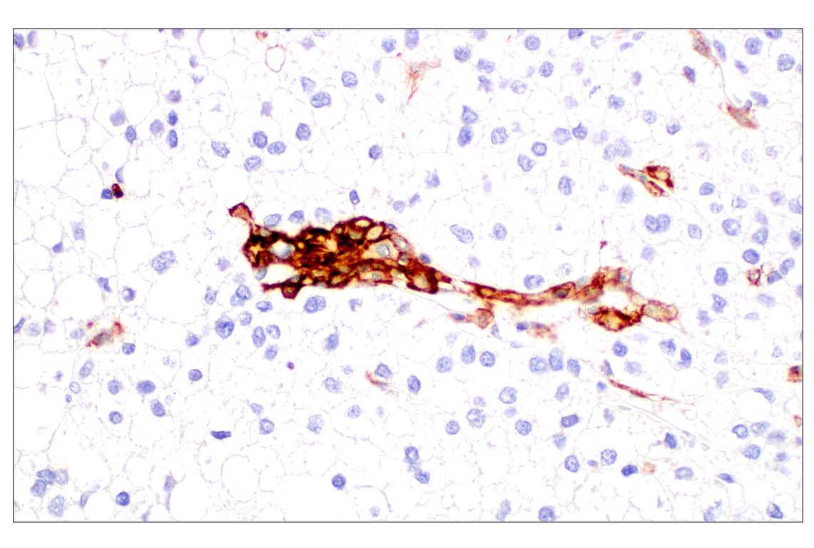 Immunohistochemistry Image 3: CD11b/ITGAM (E3J2F) Rabbit mAb