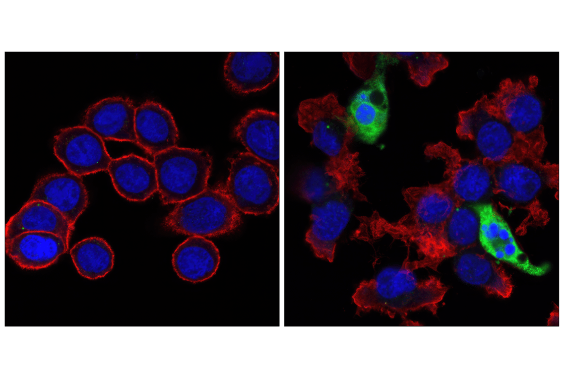 undefined Image 32: Apoptosis Antibody Sampler Kit II