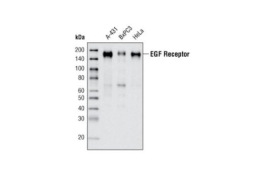 undefined Image 42: Lung Cancer RTK Antibody Sampler Kit