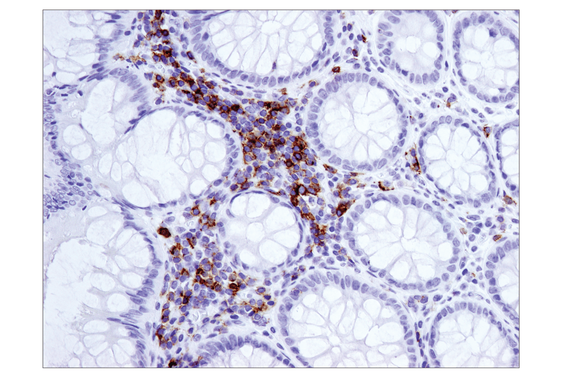 Immunohistochemistry Image 1: ICOS (D1K2T™) Rabbit mAb (BSA and Azide Free)