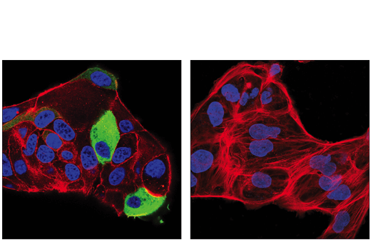 Immunofluorescence Image 1: Tyrosine Hydroxylase (E2L6M) Rabbit mAb (BSA and Azide Free)