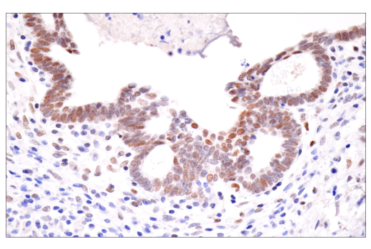 Immunohistochemistry Image 2: HIF-1α (E1V6A) Rabbit mAb