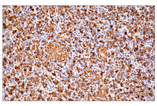 Immunohistochemistry Image 6: p22phox (E7Y1F) XP<sup>®</sup> Rabbit mAb