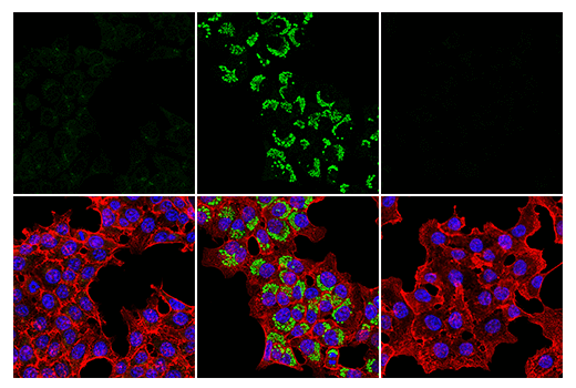 Immunofluorescence Image 1: LC3B (E7X4S) XP<sup>®</sup> Rabbit mAb