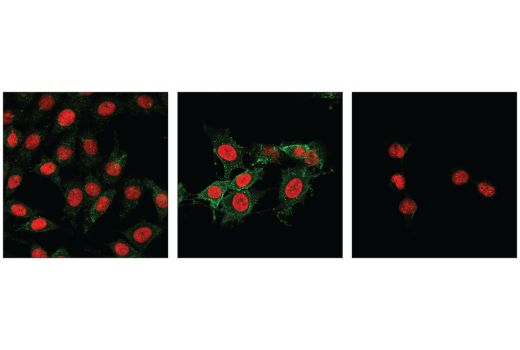 undefined Image 14: Mouse Reactive Cell Death and Autophagy Antibody Sampler Kit