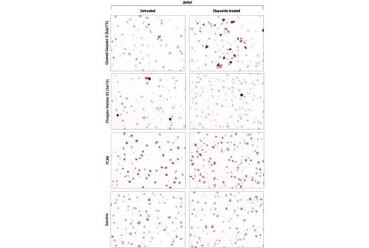 Immunohistochemistry Image 1: SignalStain<sup>®</sup> Proliferation/Apoptosis IHC Sampler Kit