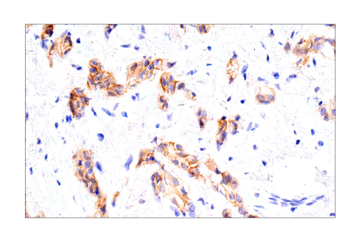 undefined Image 66: Lung Cancer RTK Antibody Sampler Kit
