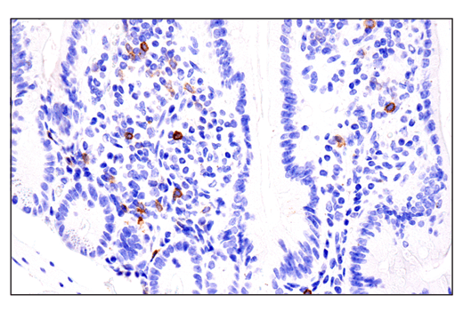 Immunohistochemistry Image 6: IL-2Rα/CD25 (E4B2Z) XP<sup>®</sup> Rabbit mAb (BSA and Azide Free)
