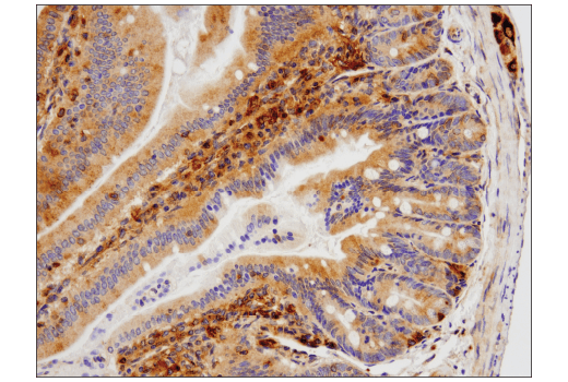 Immunohistochemistry Image 6: SQSTM1/p62 (D6M5X) Rabbit mAb