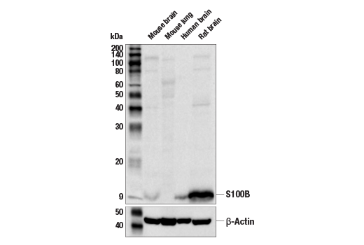 Western Blotting Image 2: S100B (E9F2I) Rabbit mAb (BSA and Azide Free)