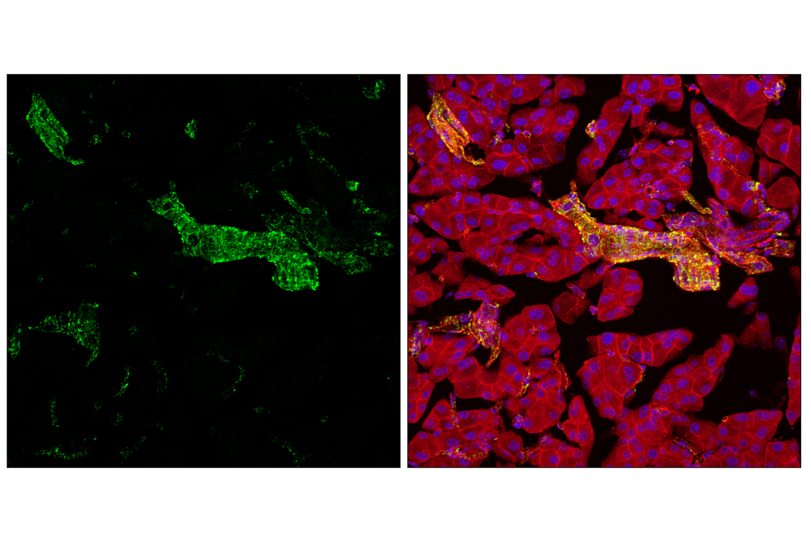 Immunofluorescence Image 2: Hexokinase I (C35C4) Rabbit mAb (BSA and Azide Free)