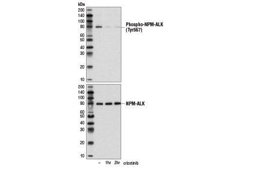 Western Blotting Image 1: Phospho-ALK (Tyr1507) (D6F1V) Rabbit mAb