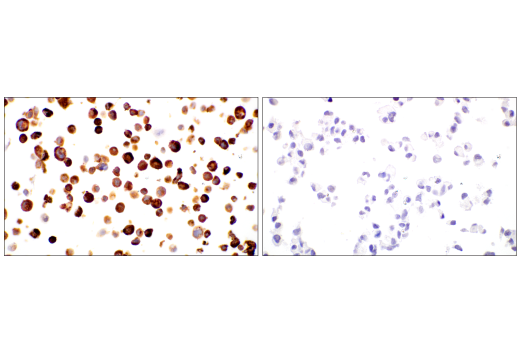 Immunohistochemistry Image 2: COL3A1 (E8D7R) XP<sup>®</sup> Rabbit mAb (BSA and Azide Free)