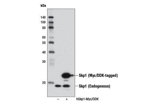 undefined Image 12: Ubiquitin E3 Ligase Complex Antibody Sampler Kit
