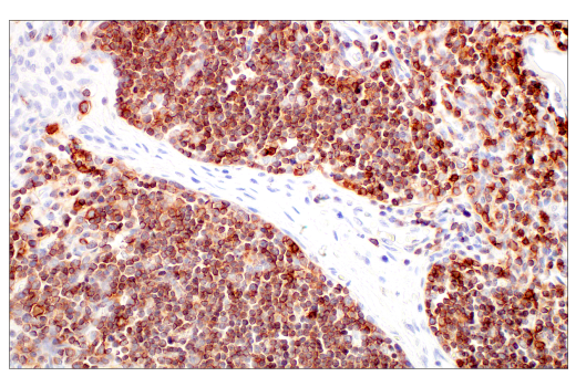 Immunohistochemistry Image 5: CD7 (E4G1Q) XP<sup>®</sup> Rabbit mAb (BSA and Azide Free)