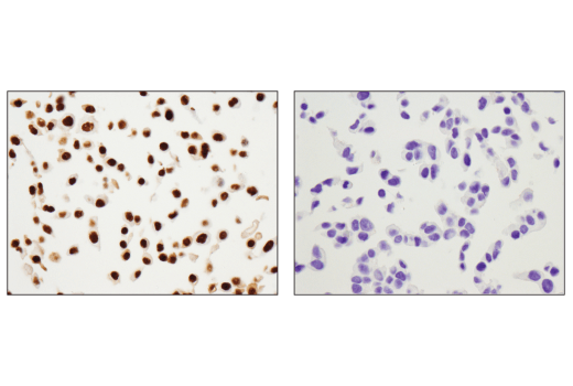 Immunohistochemistry Image 2: p63 (D9L7L) XP<sup>®</sup> Rabbit mAb