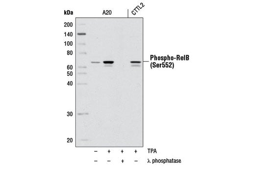 Western Blotting Image 1: Phospho-RelB (Ser552) (D41B9) XP<sup>®</sup> Rabbit mAb (BSA and Azide Free)