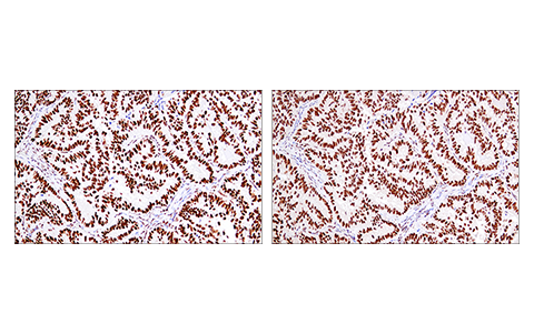 Immunohistochemistry Image 1: 53BP1 (E7N5D) XP<sup>®</sup> Rabbit mAb (BSA and Azide Free)