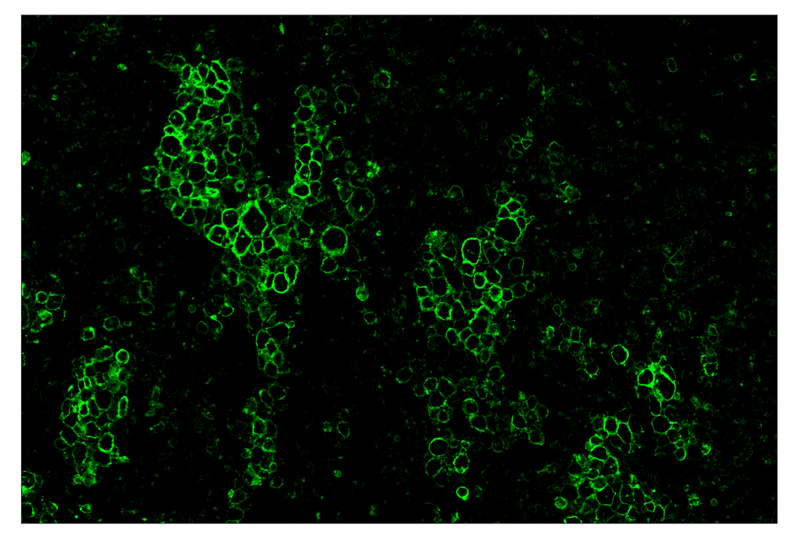 Immunohistochemistry Image 2: CD86 (E2G8P) & CO-0038-594 SignalStar<sup>™</sup> Oligo-Antibody Pair