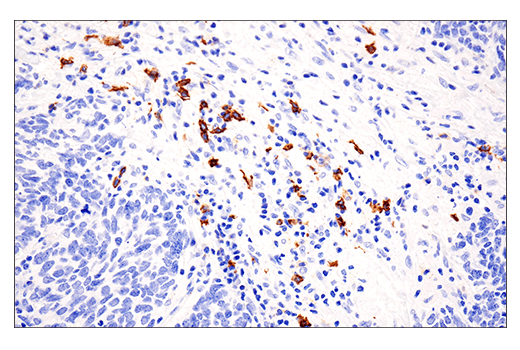Immunohistochemistry Image 4: CD20 (E7B7T) XP<sup>®</sup> Rabbit mAb