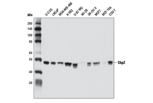 Western Blotting Image 1: Skp2 (D3G5) XP<sup>®</sup> Rabbit mAb