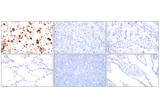 Immunohistochemistry Image 3: SARS-CoV-2 Nucleocapsid Protein (E9L7H) XP<sup>®</sup> Rabbit mAb