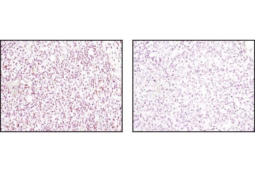 Immunohistochemistry Image 1: AML1 (D33G6) XP<sup>®</sup> Rabbit mAb