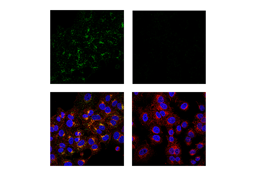 Immunofluorescence Image 1: APP (E9M5J) Rabbit mAb