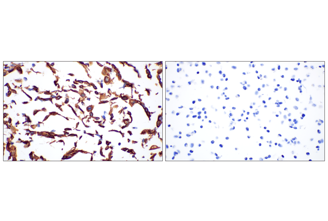 Immunohistochemistry Image 10: Keratin 14 (E7W6V) Rabbit mAb