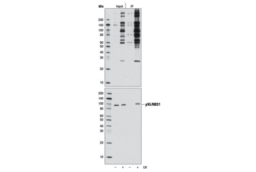 Immunoprecipitation Image 1: Phospho-ATM/ATR Substrate Motif [(pS/pT) QG] MultiMab<sup>® </sup> Rabbit mAb mix