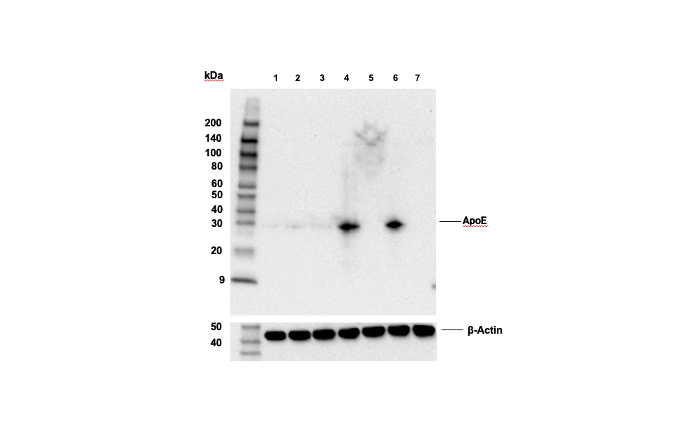 Western Blotting Image 2: ApoE (E7X2A) Rabbit mAb (BSA and Azide Free)