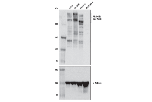 Western Blotting Image 1: ARID1B/BAF250B (E9J4T) Rabbit mAb