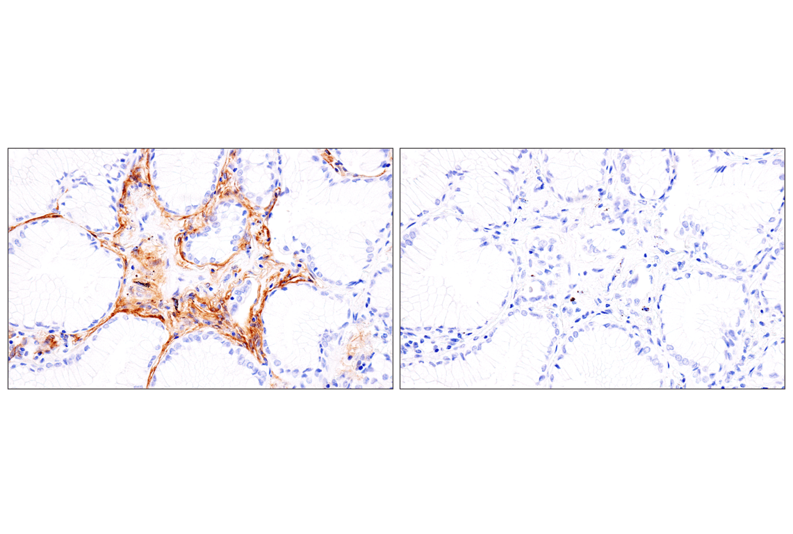 Immunohistochemistry Image 20: p75NTR (E7I3M) Rabbit mAb