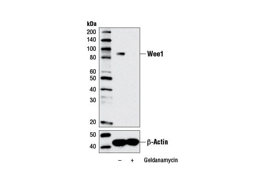 Western Blotting Image 1: Wee1 (D10D2) Rabbit mAb
