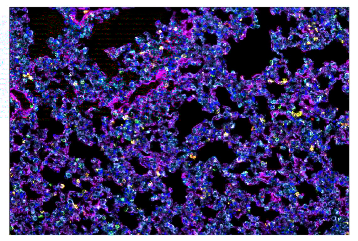 Immunohistochemistry Image 1: Pan-Keratin (Type I) (E6S1S) & CO-0072-750 SignalStar™ Oligo-Antibody Pair