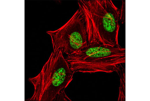 Immunofluorescence Image 1: Di-Methyl-Histone H3 (Lys9) (D85B4) XP<sup>®</sup> Rabbit mAb (BSA and Azide Free)