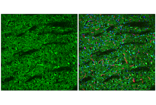 Immunofluorescence Image 2: CaMKII-γ (E4C3O) Rabbit mAb