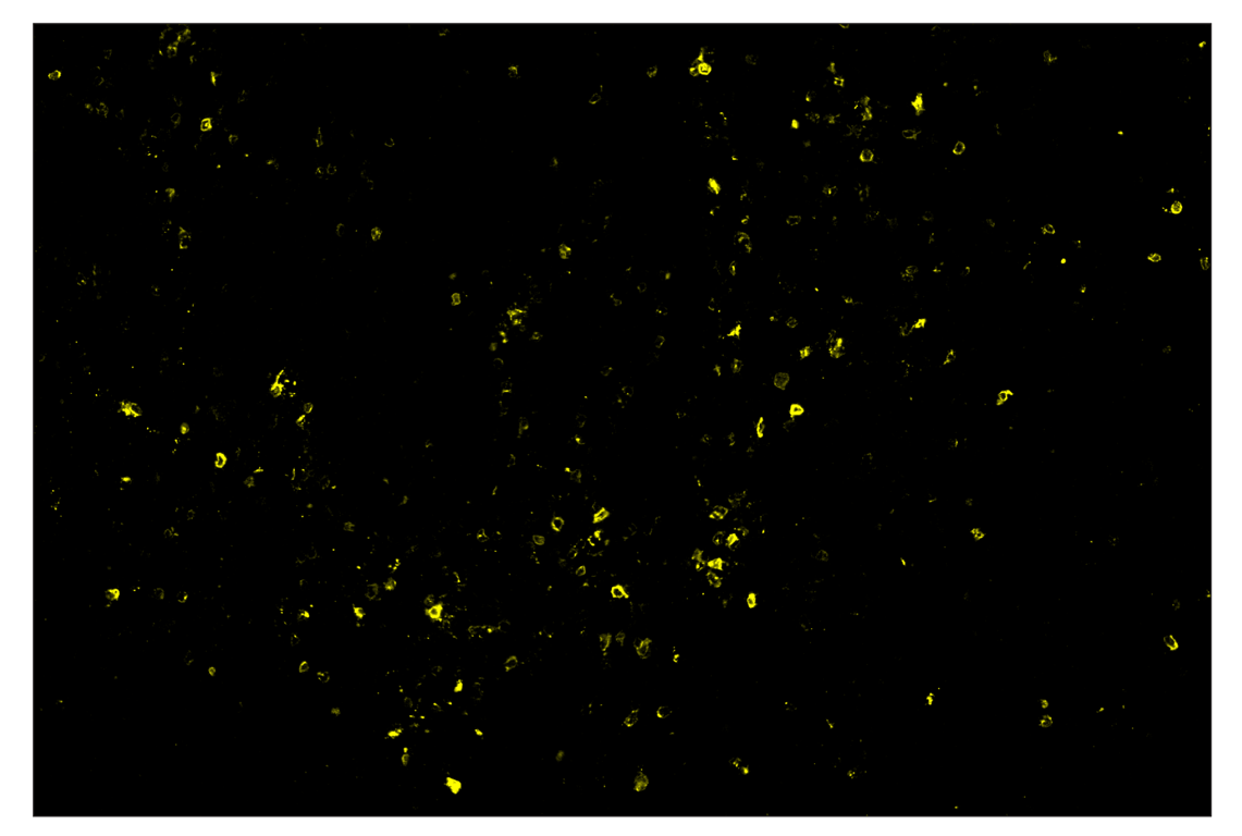 Immunohistochemistry Image 2: OX40 (E9U7O) & CO-0086-594 SignalStar<sup>™</sup> Oligo-Antibody Pair