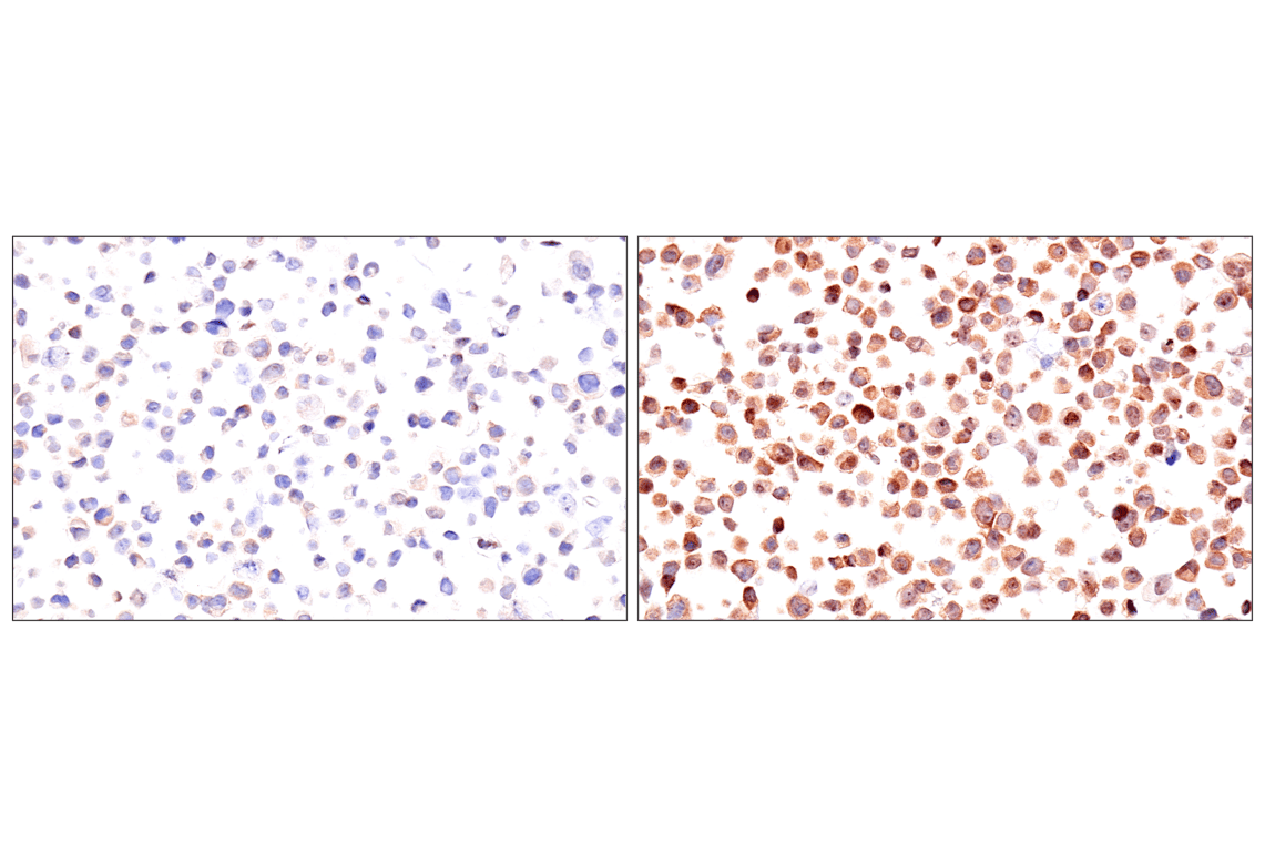 Immunohistochemistry Image 15: ADAR1 p150 Isoform (E6U1U) Rabbit mAb