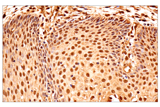 Immunohistochemistry Image 9: Ubiquitin (E6K4Y) XP<sup>®</sup> Rabbit mAb (BSA and Azide Free)